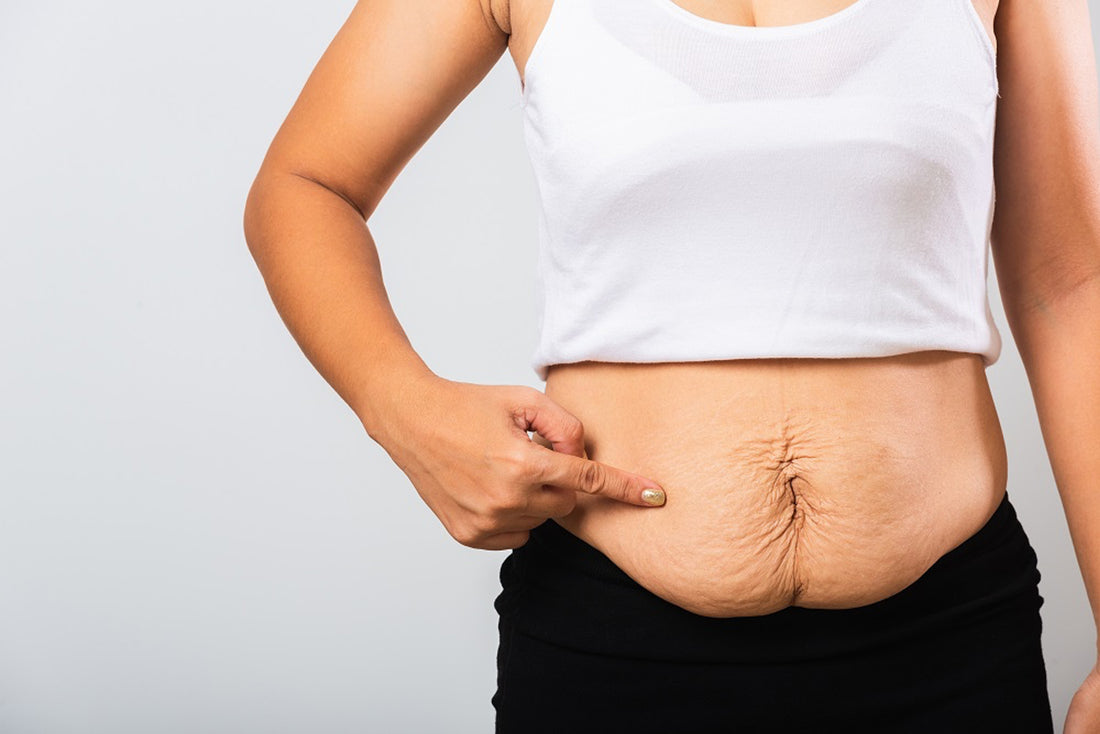 The Essential Guide to Cosmetic Cream Use After Bariatric Surgery