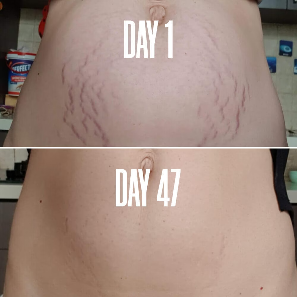 B-FLAT Belly Firming Cream - Barifit